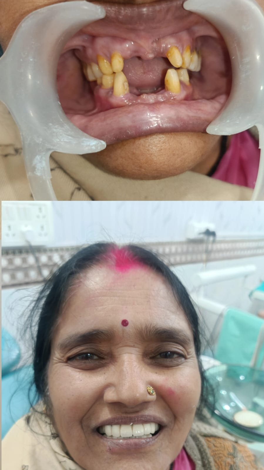 Prosthodontics Before and After